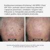 Slika Eryfotona AK-NMSC Fluid SPF 100+